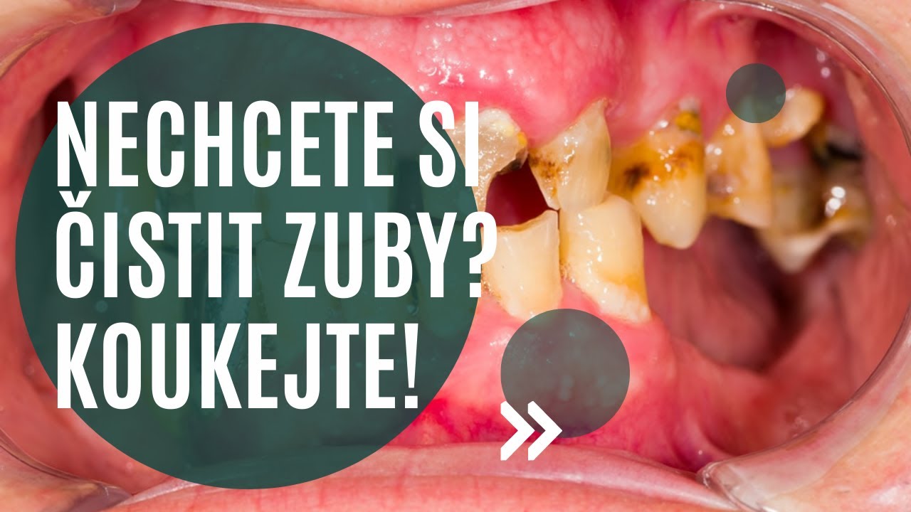 👀 Co se stane, když si nebudeme čistit zuby?