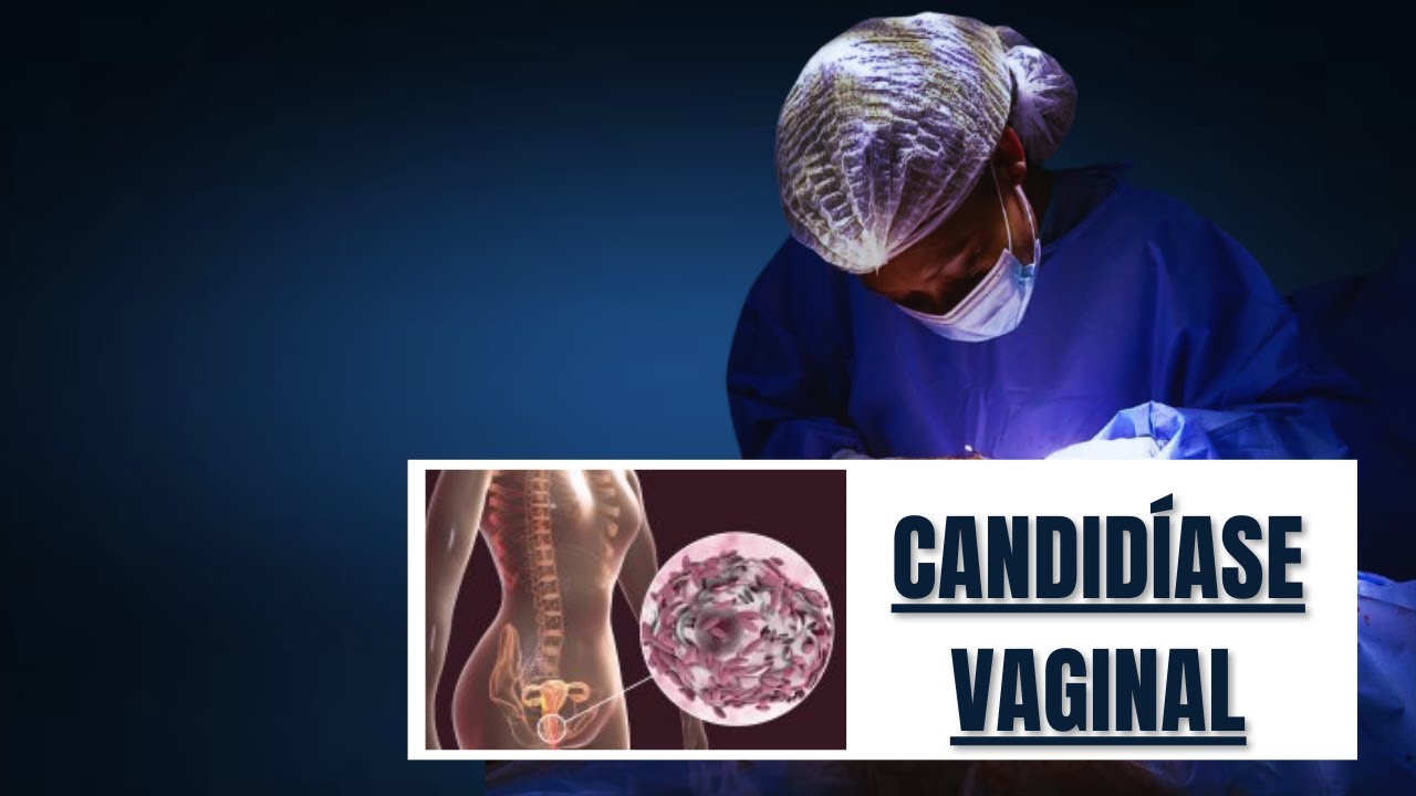 📝 CANDIDÍASE - AULA de ESPECIALIZAÇÃO em GINECOLOGIA e OBSTETRÍCIA 
