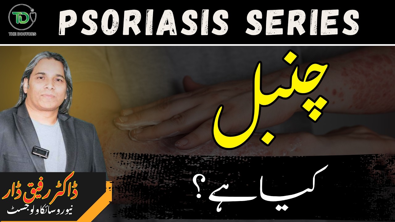 What Is Psoriasis? (Psoriasis Series) | Dr Rafiq Dar
