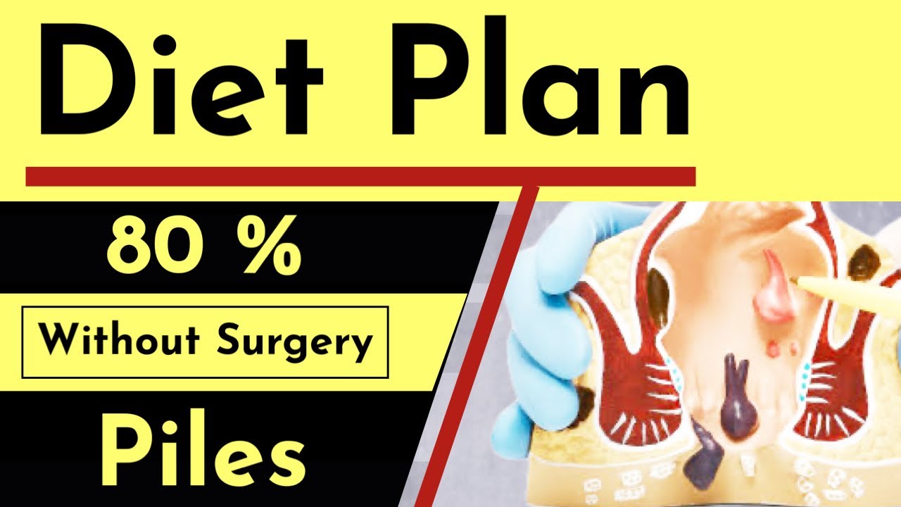 80 % Treatment Without Operation : PILES Indian DIET plan ? kya khana hai Bavasir mein ?Haemorrhoids