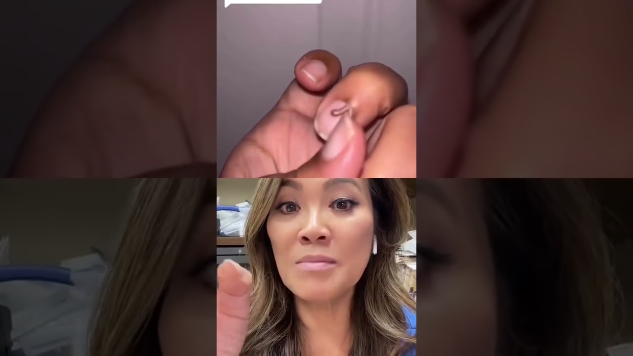 &ldquo;That is so cute!&rdquo; Dr Pimple Popper Reacts 🥰 #shorts