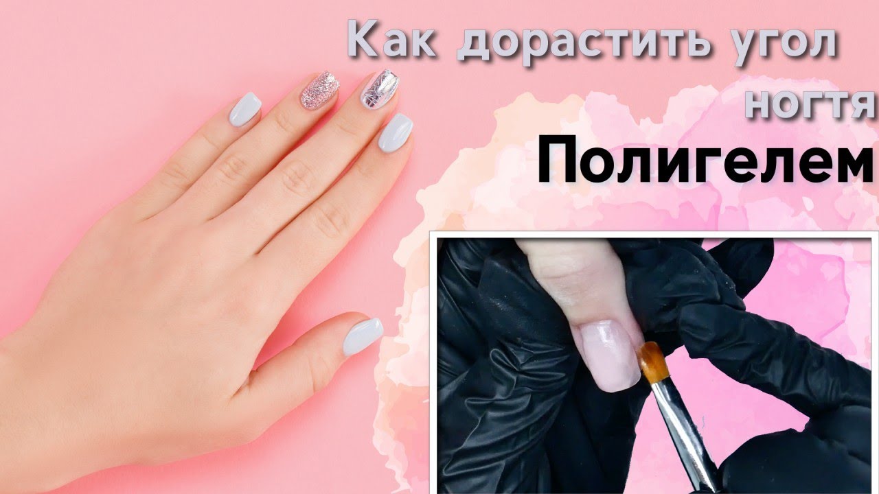 Как дорастить угол ногтя Полигелем