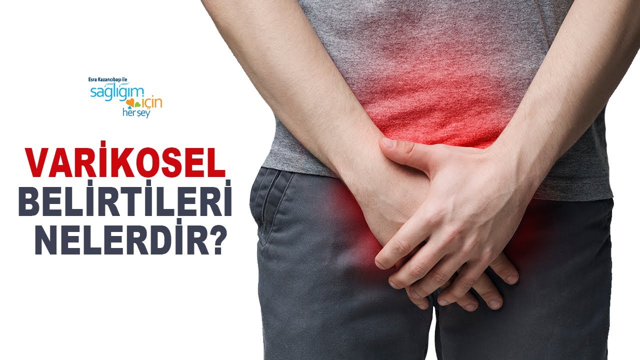 Varikosel Ağrısı Başka Hastalıklarla Karışabilir mi?