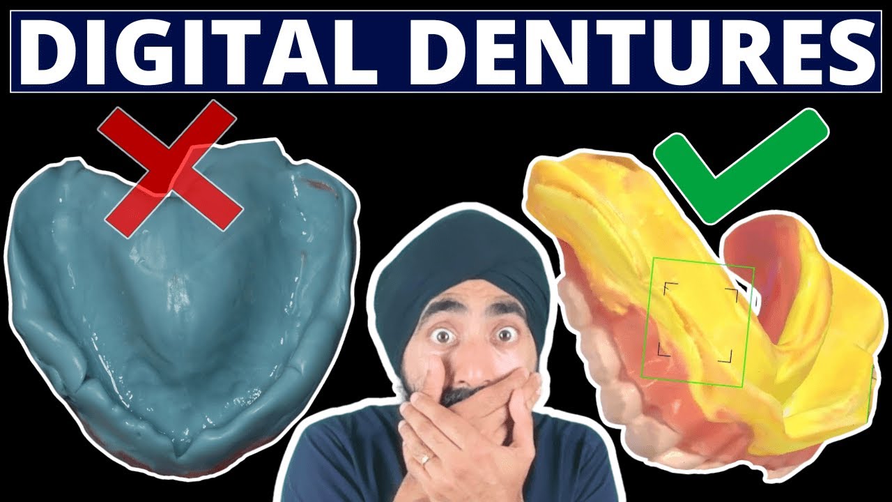 Digital Dentures for Every Dentist - The Death of Impressions? - PDP195