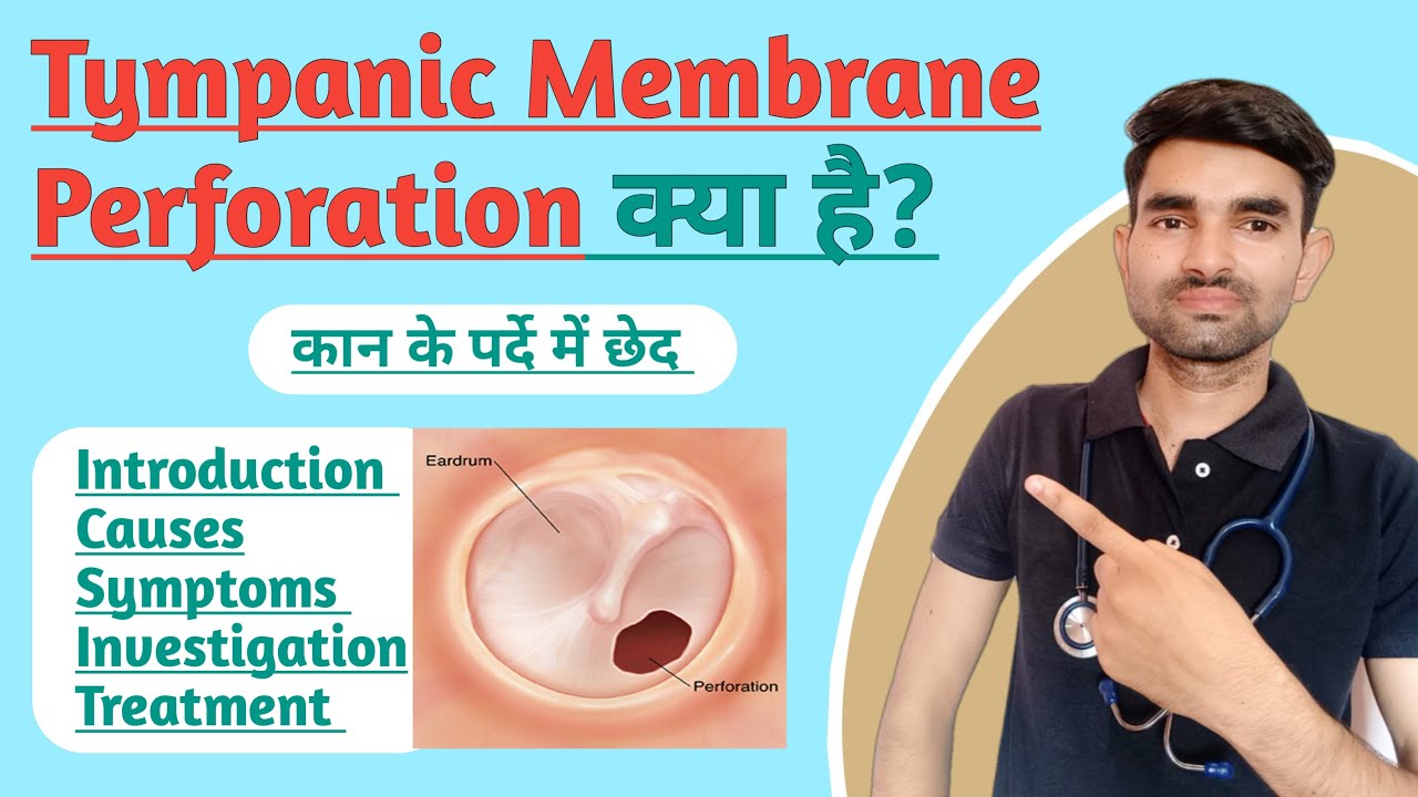 Tympanic Membrane Perforation in Hindi | Causes, Symptoms & Treatment of Damage Eardrum