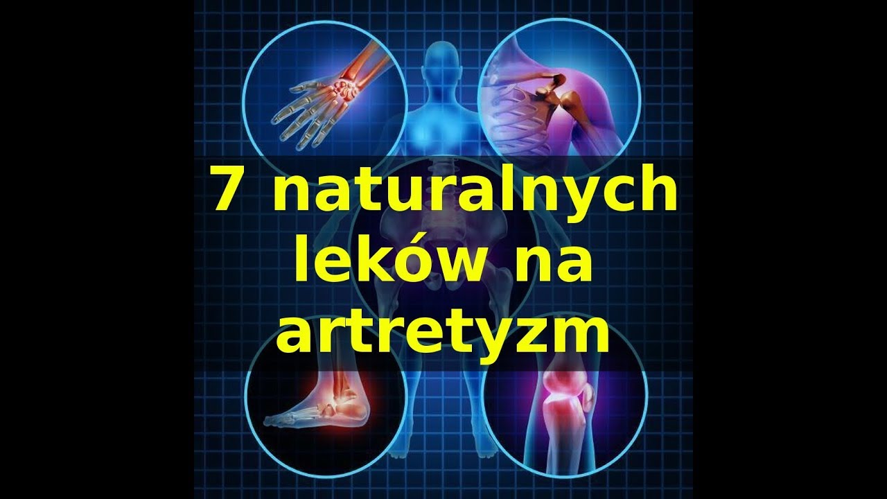 Artretyzm - 7 naturalnych lek&oacute;w na artretyzm