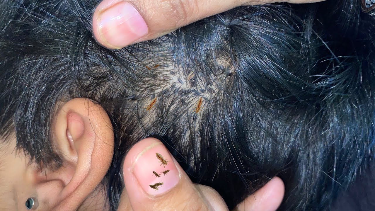 Lice Checking ASMR part3 #lice #haircare #asmr #piojos #kututv 