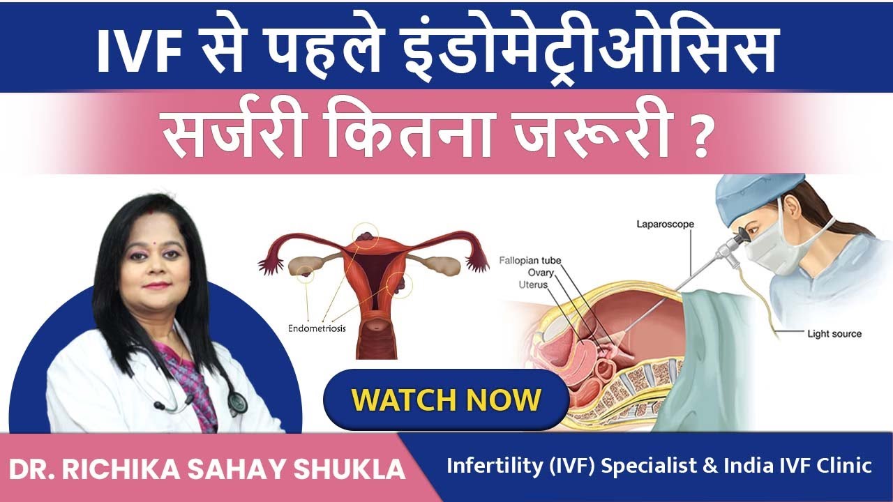 IVF से पहले इंडोमेट्रीओसिस सर्जरी कितना जरूरी ? Endometriosis before IVF in Hindi | India IVF Clinic