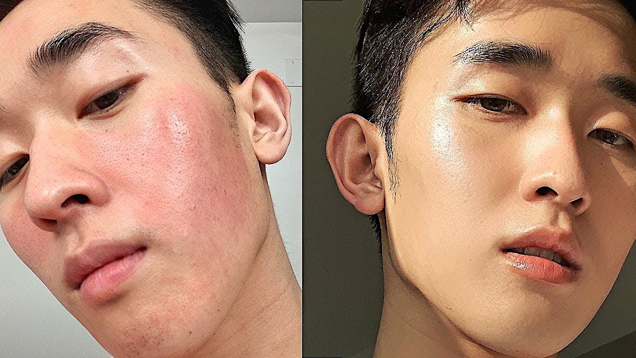 HOW I CALM MY SENSITIVE SKIN | redness, acne, sunburns