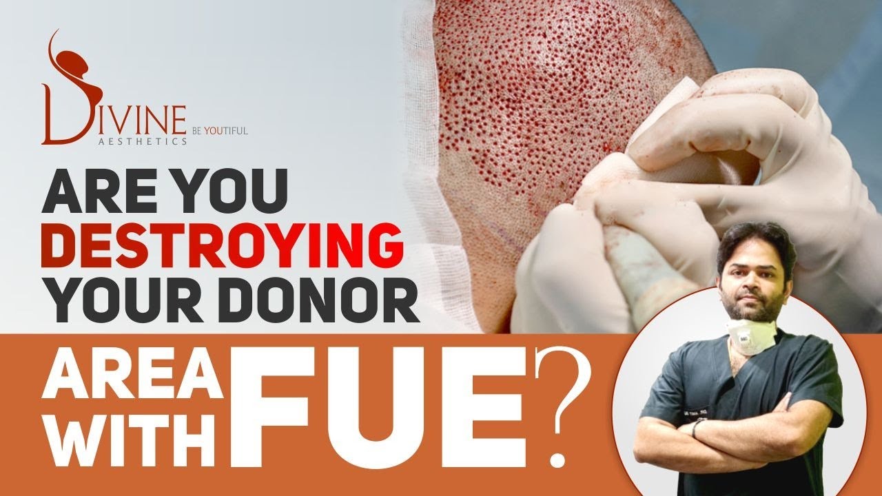 Are You Destroying Your Donor Area With FUE?