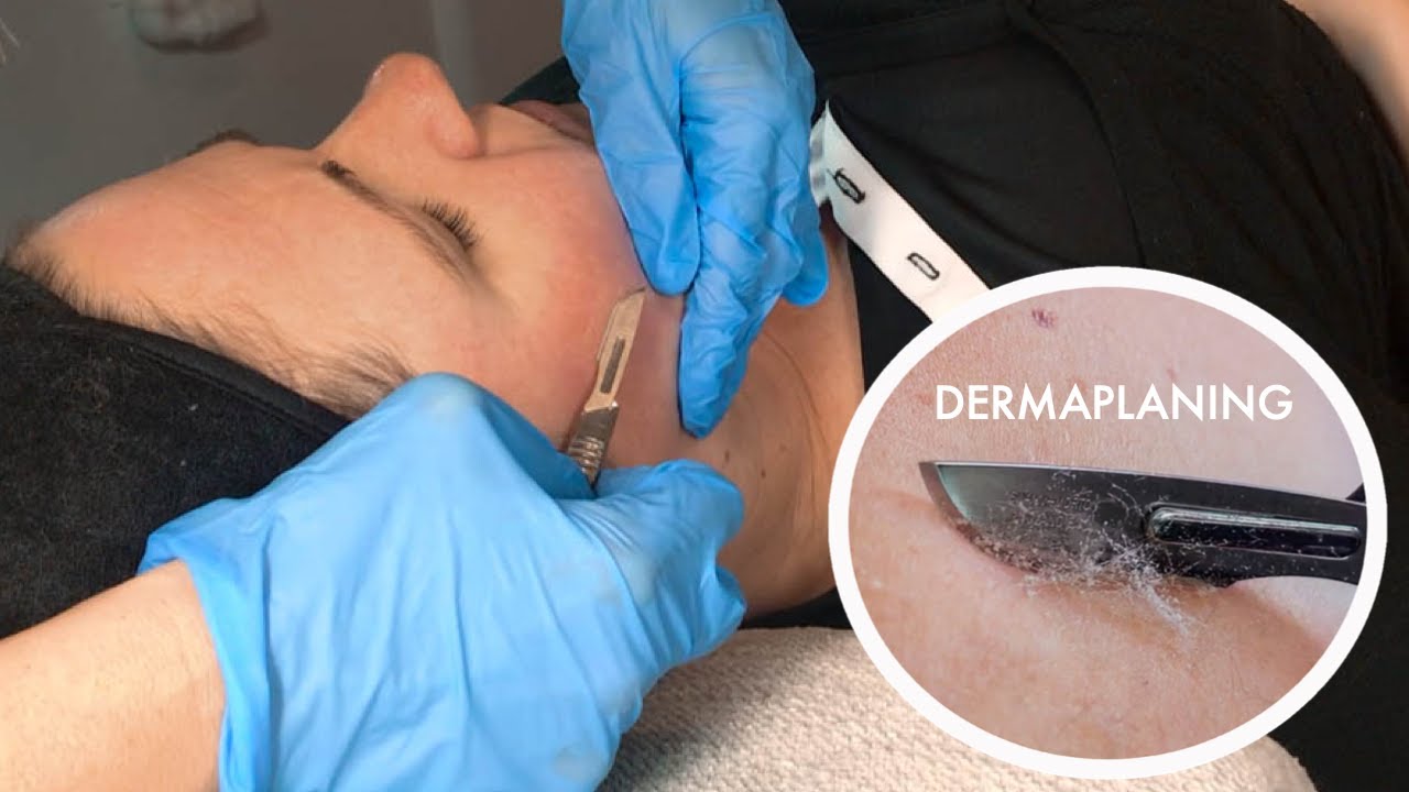 Dermaplaning beauty treatment on dehydrated skin