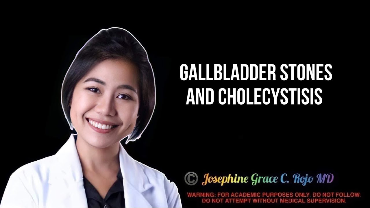 Gallbladder Stones and Cholecystitis:  | WAZZUP DOC LIVE | 