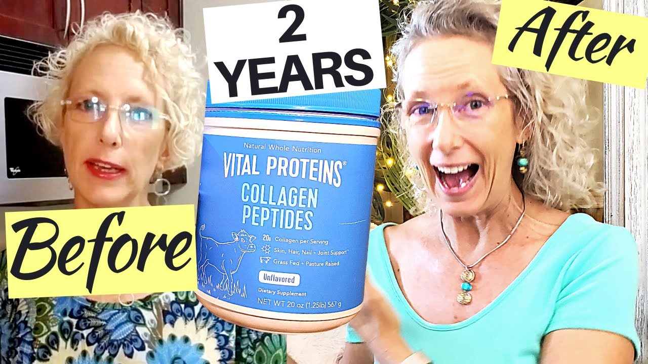 Collagen Before & After | Results After 2 Years Using Collagen Peptides Daily