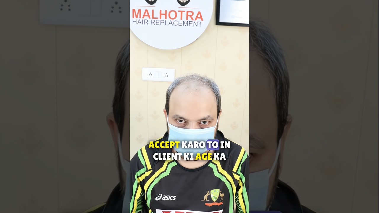 Hair patch side effects| Hair  Patch for men| Hair Patches