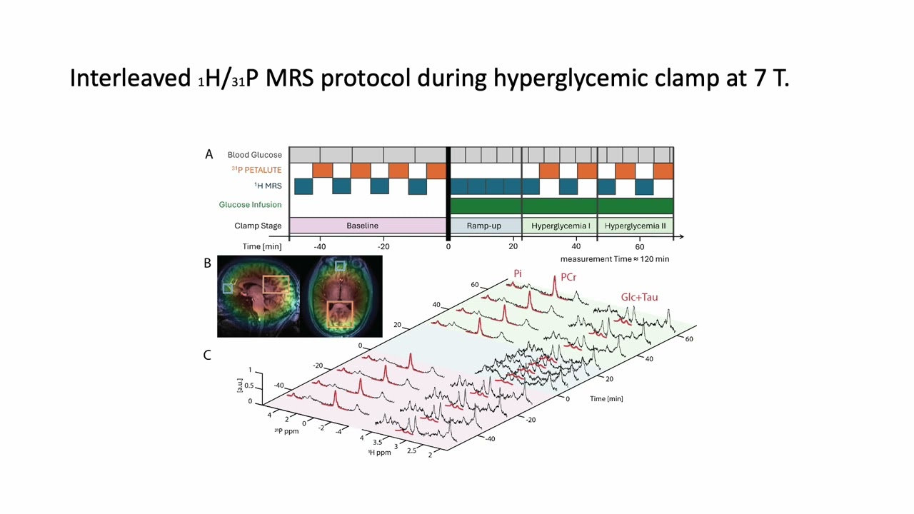 Modified Rosette PETALUTE 1H MRS 31P MRSI at 7T Brain Energy Metabolism Responses to Hyperglycemia
