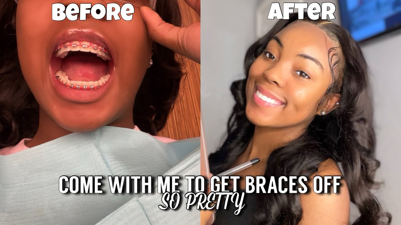 COME WITH ME TO GET MY BRACES OFF || Yasmin Alisha