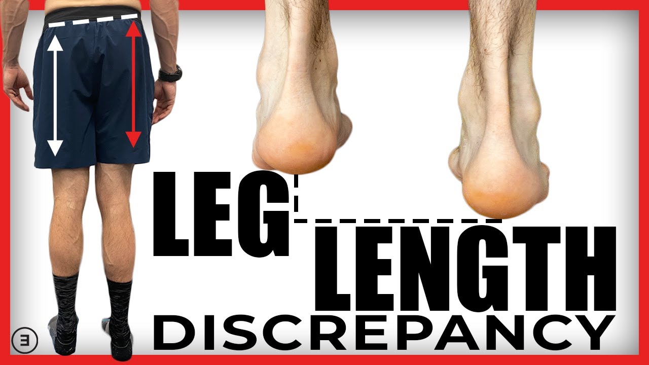 Leg Length Discrepancy (Why It Probably Doesn't Matter | Evidence Based)