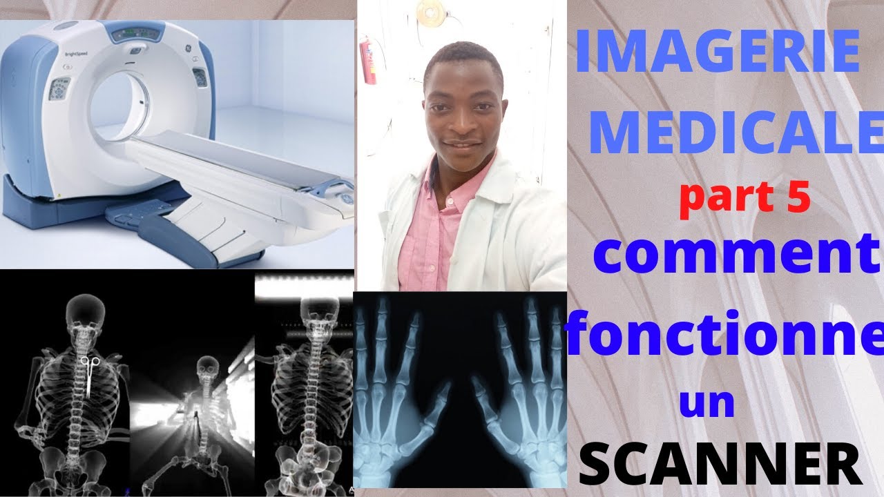 IMAGERIE MÉDICALE part5: Comment fonctionne un scanner/ How a scanner works