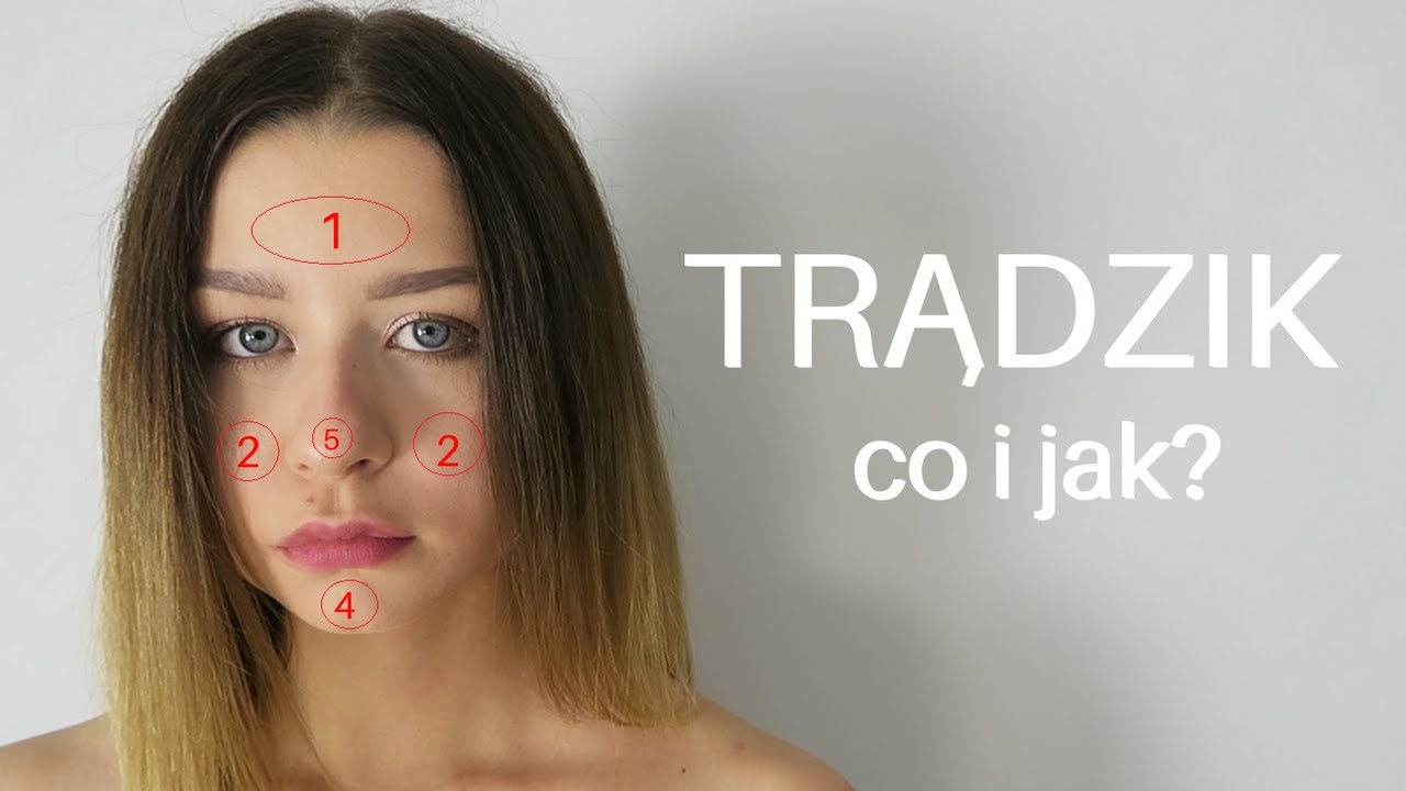 Jak wyleczyłam trądzik | Wszystko o trądziku