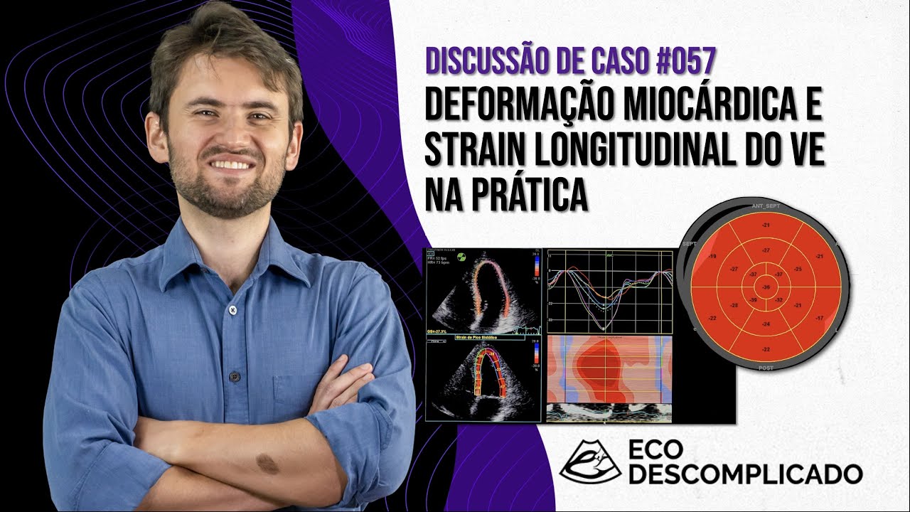 EcoDescomplicado - Discussão de caso #057 - Speckle Tracking e Strain Global Longitudinal do VE