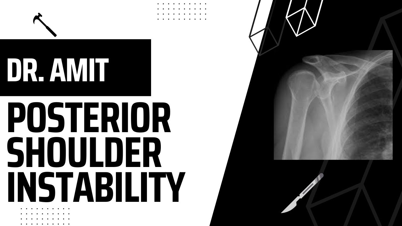 102: Posterior Shoulder Instability w/ Dr. Momaya
