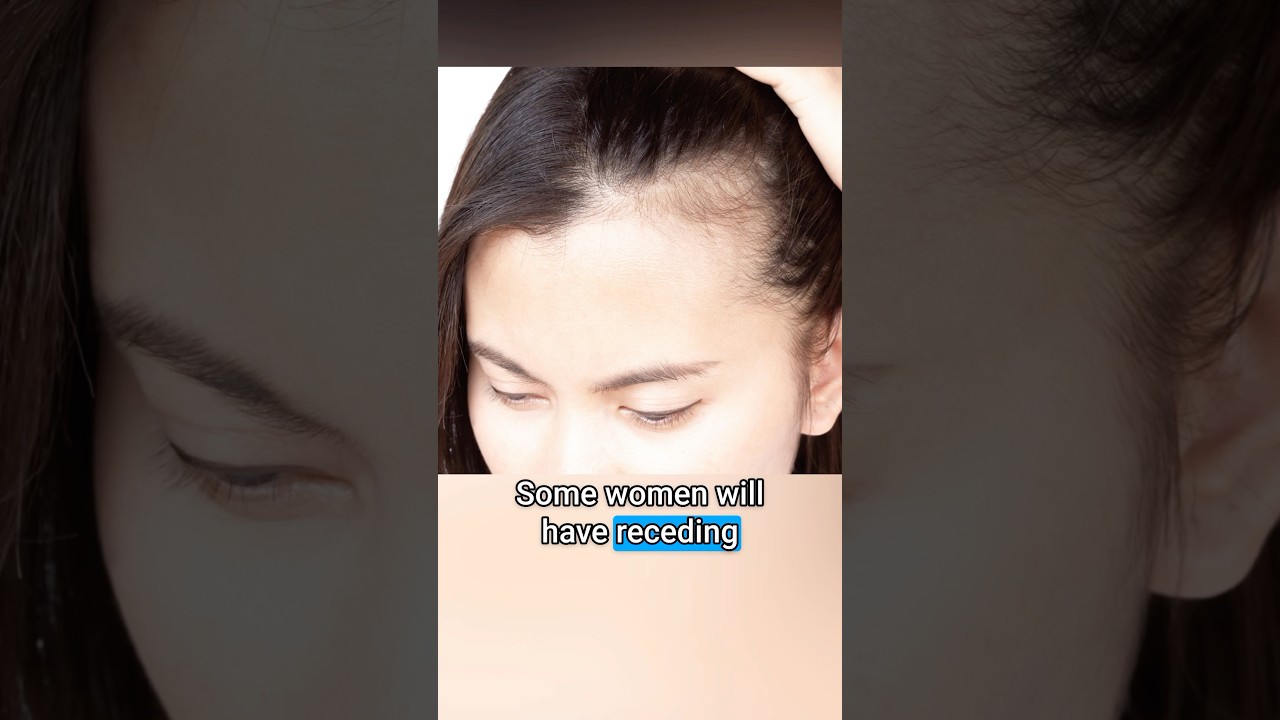 Differentiating Female Pattern Hair Loss from Telogen Effluvium #hairthinning #hairshedding