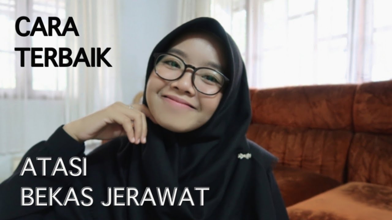 CARA MENGHILANGKAN BEKAS JERAWAT || Beauty Talk #2