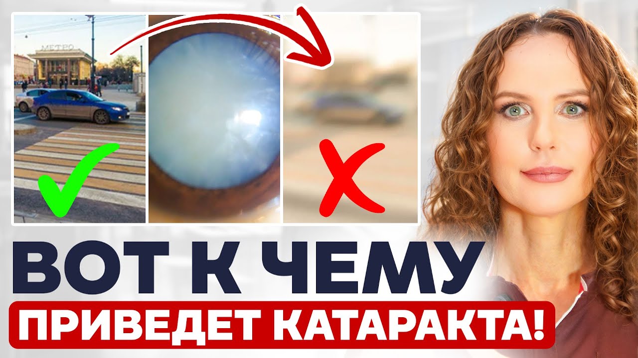 Как катаракта может лишить вас зрения НАВСЕГДА?