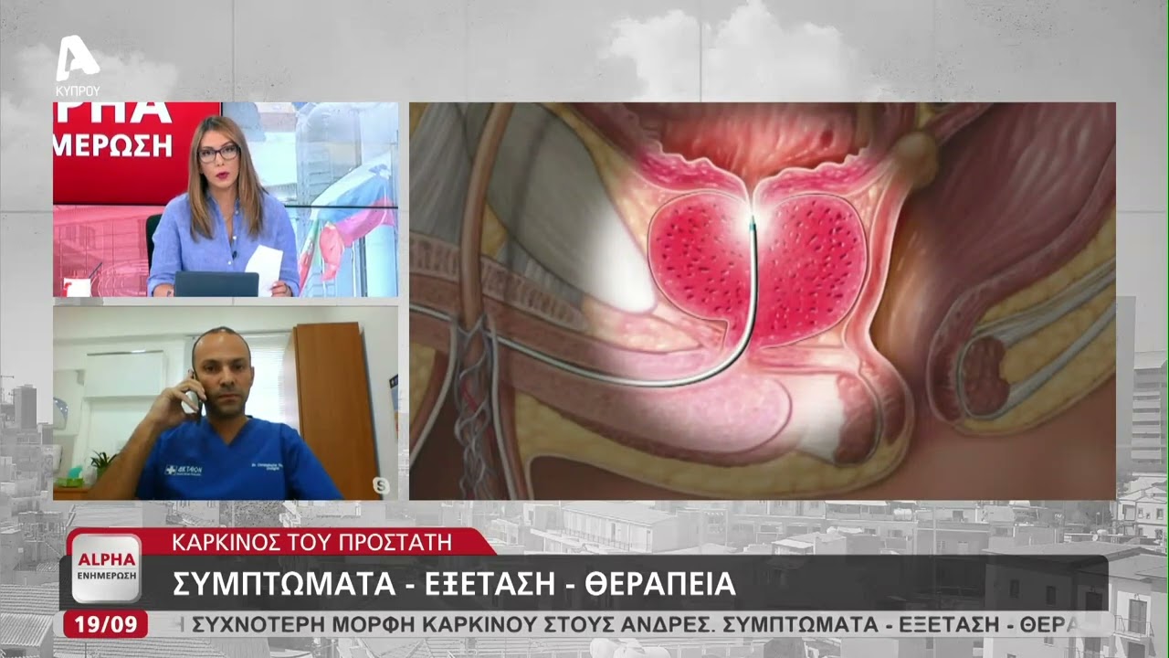 Καρκίνος του Προστάτη: Τα συμπτώματα, η διάγνωση και η θεραπεία