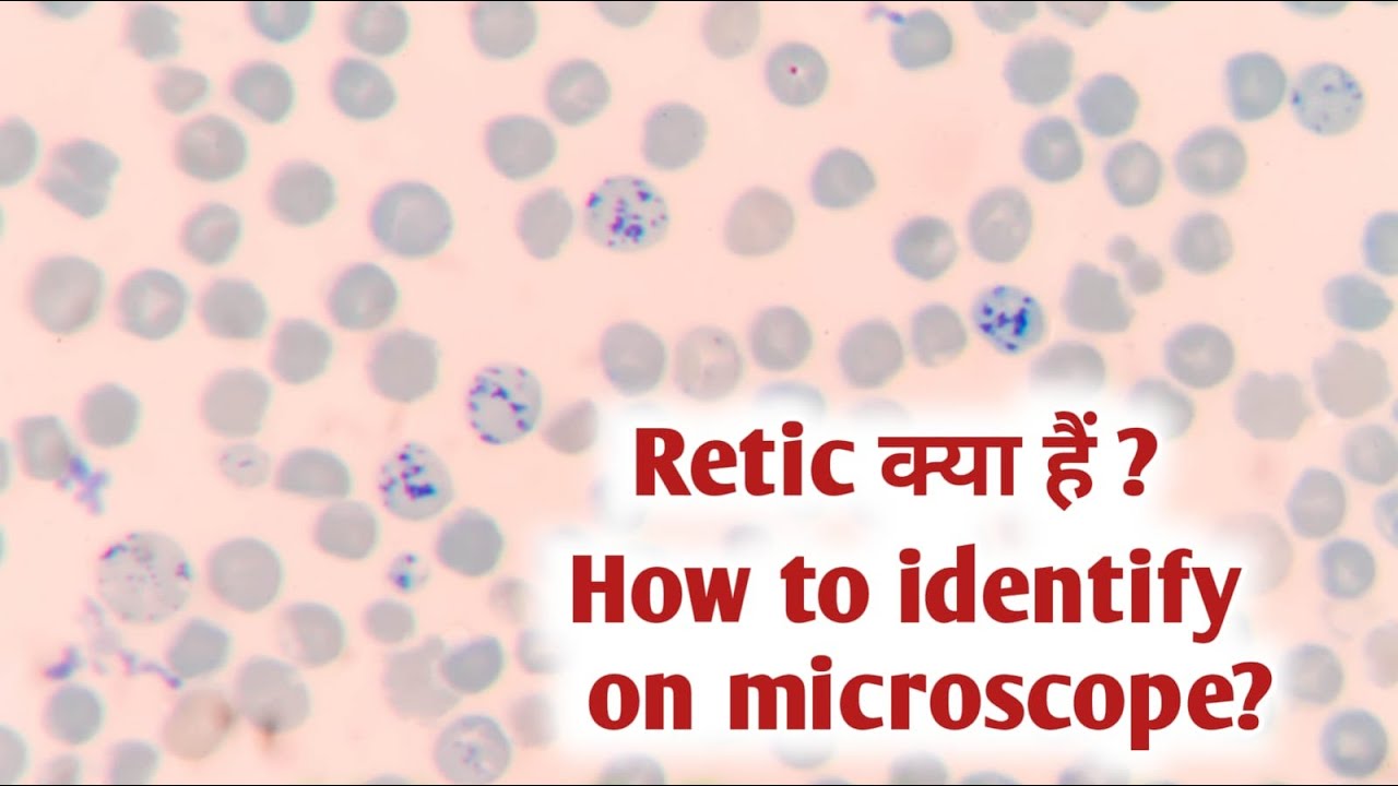Reticulocyte count under microscope