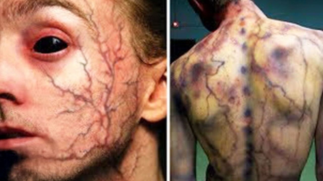 Top 10 Medical Cases Doctors Couldn’t Explain