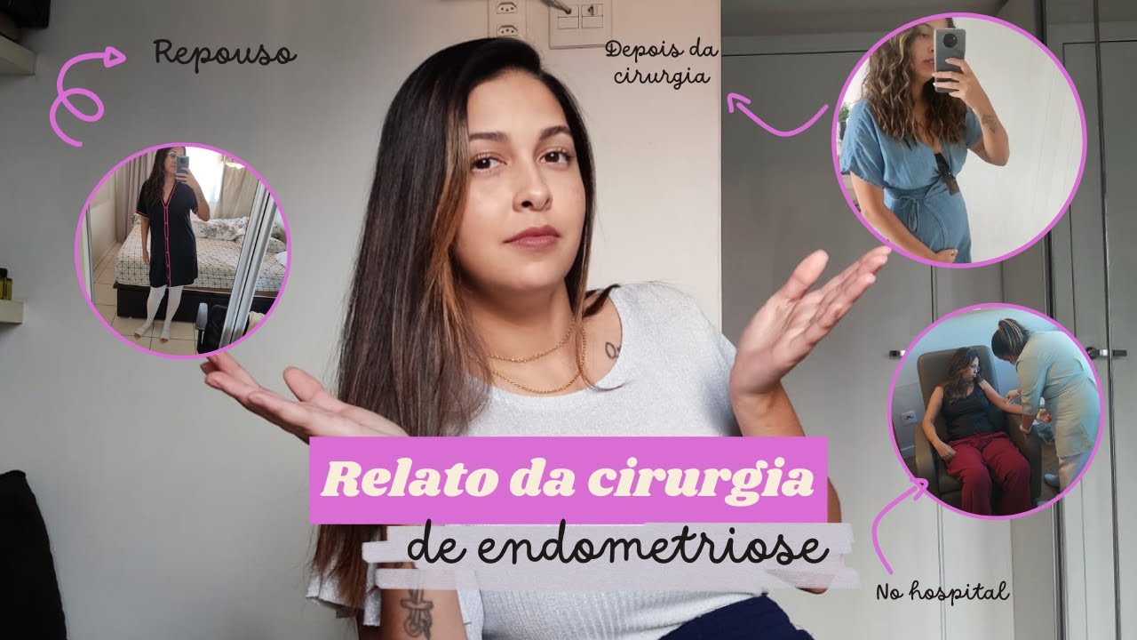 Meu relato da cirurgia de endometriose videolaparoscopia : Experiência e recuperação