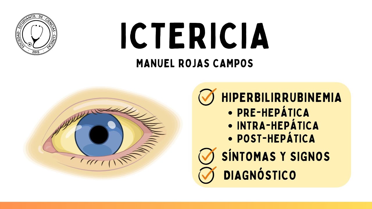 ICTERICIA: Mecanismos de hiperbilirrubinemia (fisiopatología), Síntomas y Diagnóstico | Semiología