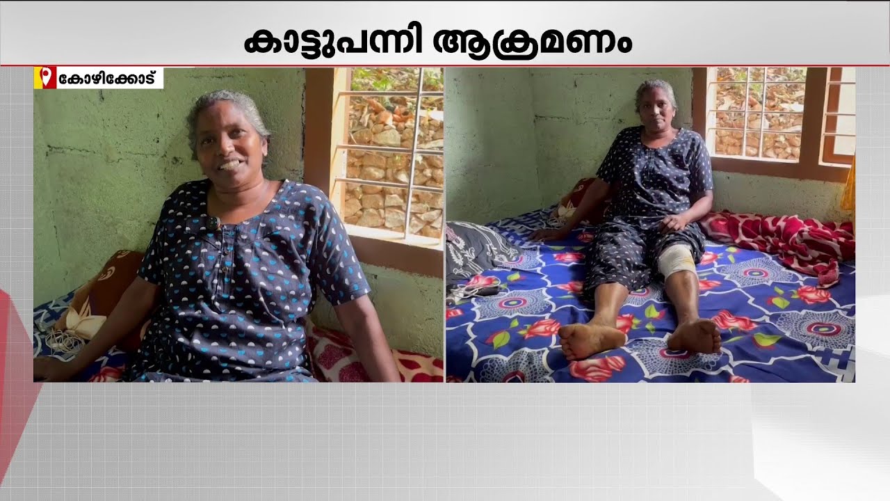 വീണ്ടും കാട്ടുപന്നി ആക്രമണം; കോഴിക്കോട് വീട്ടമ്മയ്ക്ക് പരിക്കേറ്റു | Kozhikode
