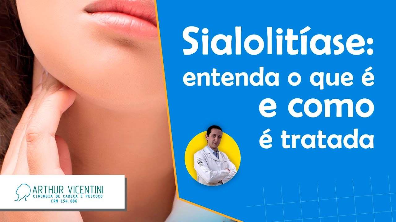 Sialolitíase: entenda o que é e como é tratada | Arthur Vicentini CRM 154.086