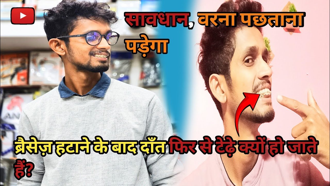 Braces remove ke baad teeth phir se tedha! Kyu hota hai?