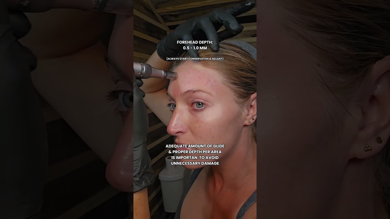 Microneedling Tutorial with Dr.Pen M7S: Step-by-Step Guide