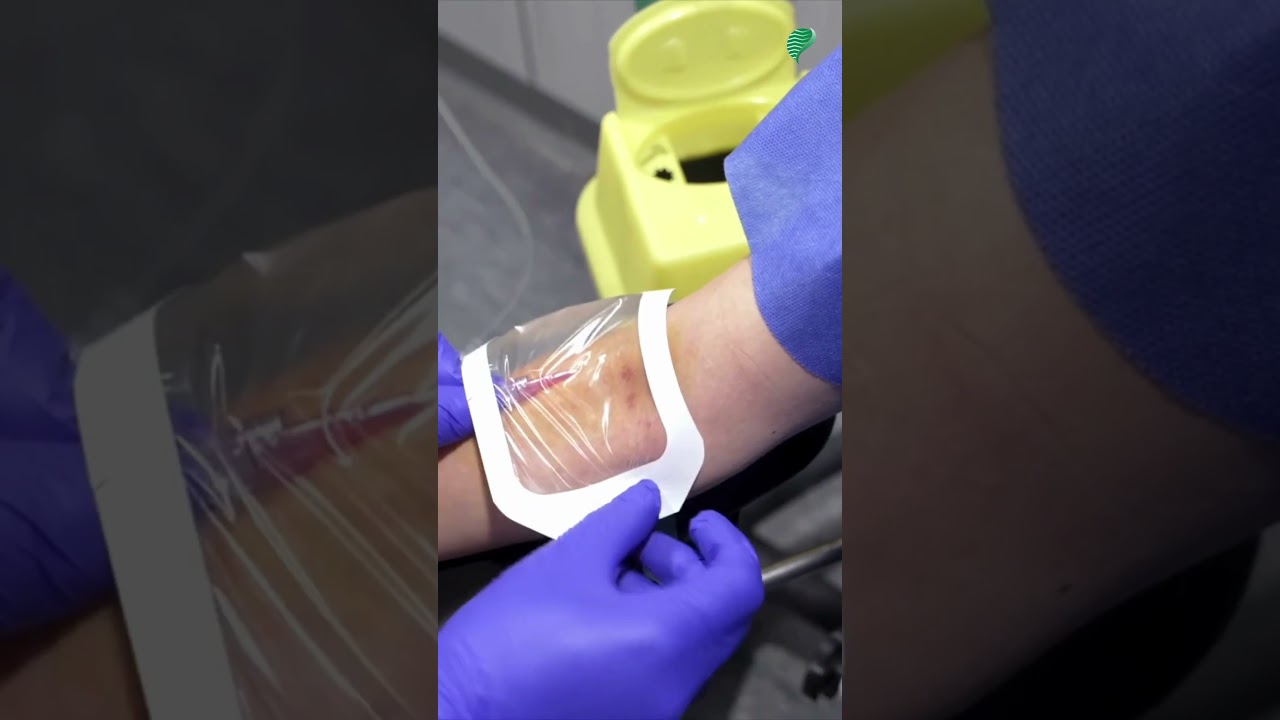 Scanner Thoracique : Tout ce qu'il Faut Savoir ! 🩻✨ #Radiologie #Diagnostic