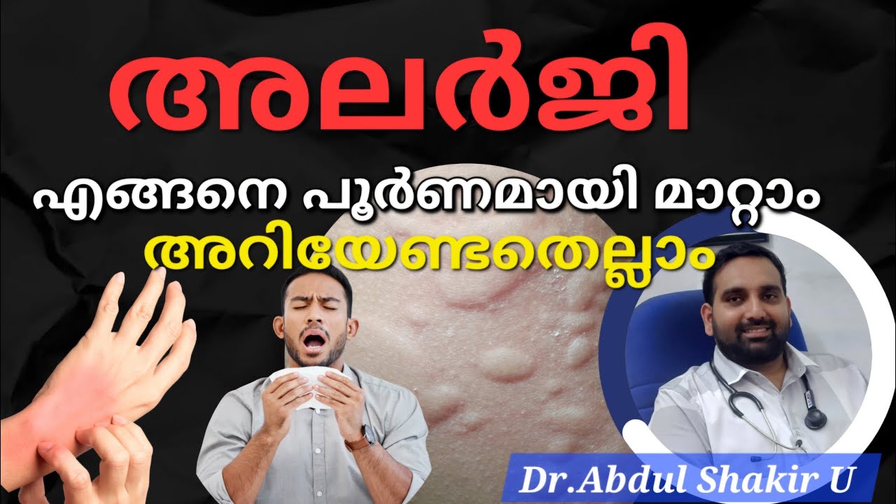 അലർജി എങ്ങനെ പൂർണമായി മാറ്റാം അറിയേണ്ടതെല്ലാം...#doctor #allergy #homoeopathy #kerala #malayalam