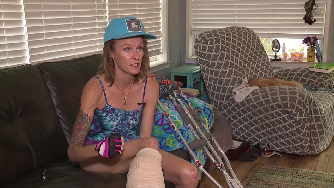 Florida woman survives alligator attack in the Hillsborough River