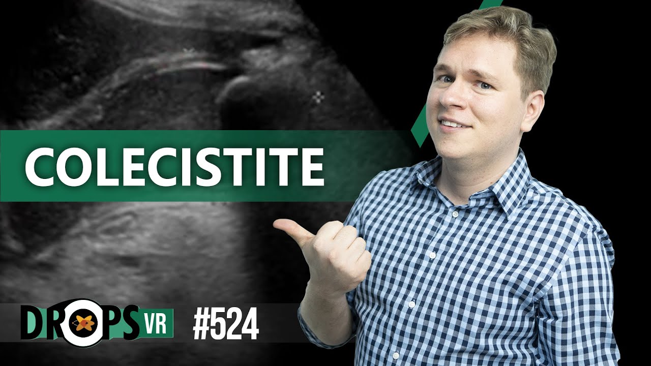 RECONHECENDO COLECISTITE NA ULTRASSONOGRAFIA I VOC&Ecirc; RADIOLOGISTA