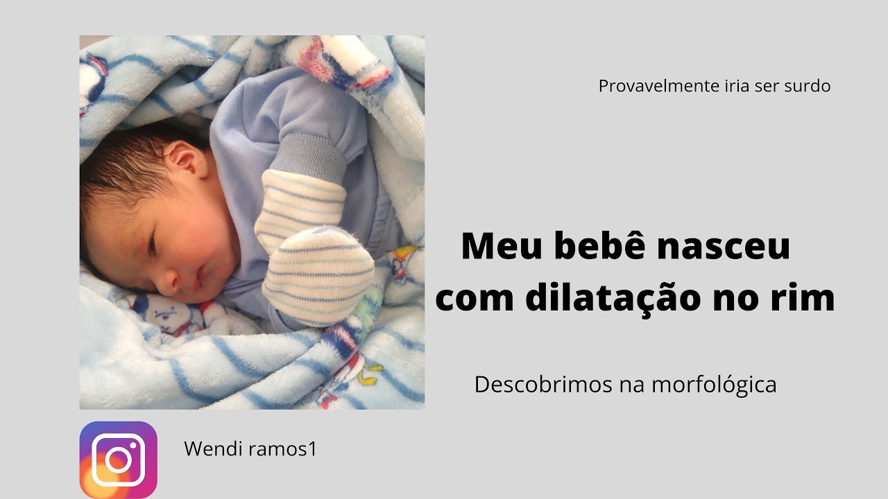 dilata&ccedil;&atilde;o no rim do meu beb&ecirc; descobrimos na ultrassom morfol&oacute;gica #mamae