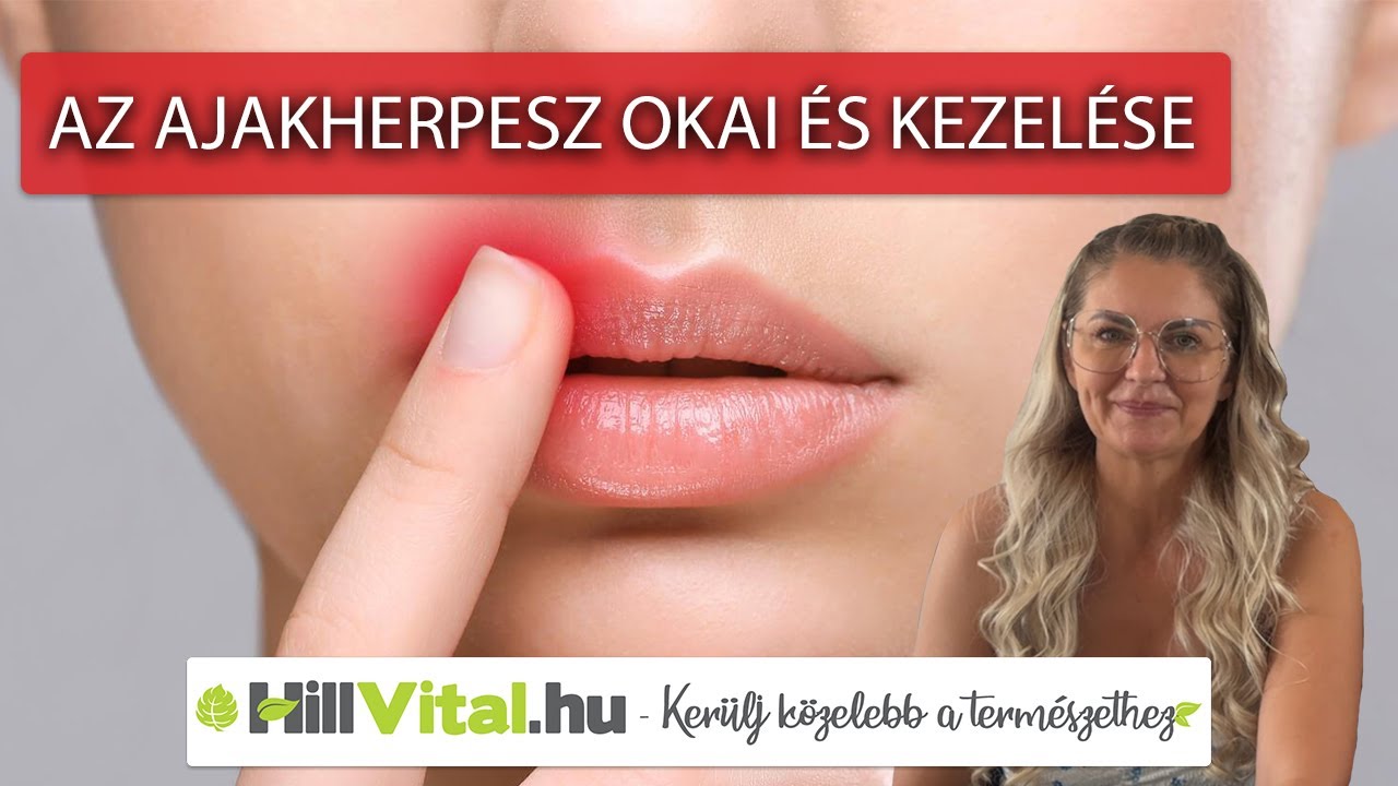 Ezek az ajakherpesz okai &eacute;s kezel&eacute;si m&oacute;djai ☝️👄 - hillvital.hu