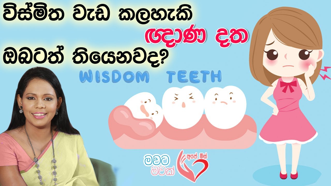 වද දෙන ඥානදත ඔබටත් තියෙද ? wisdom teeth | Ape Miss