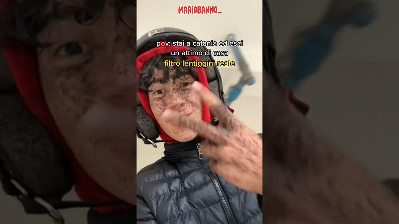 Mario ci insegna come ottenere il filtro lentiggini nella vita Reale