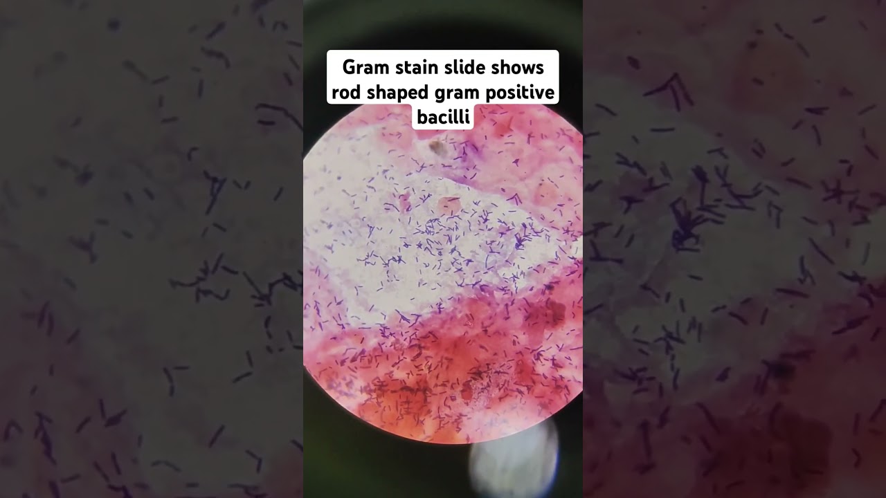 Rod shape bacilli #drmicro #microscope #infection