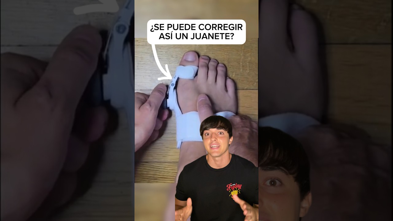 &iquest;Funcionan los correctores de juanetes?