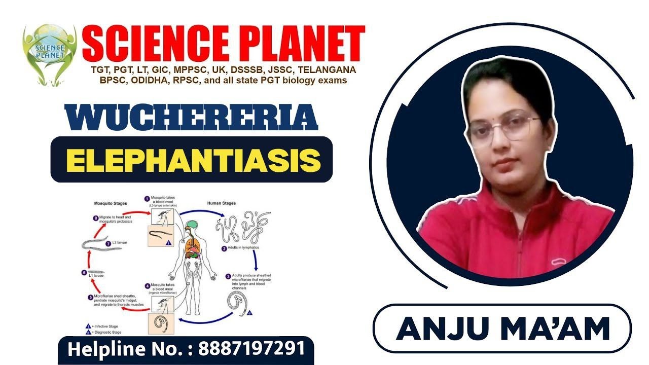 WUCHERERIA (ELEPHANTIASIS) II BY ANJU MAM II SCIENCE PLANET II