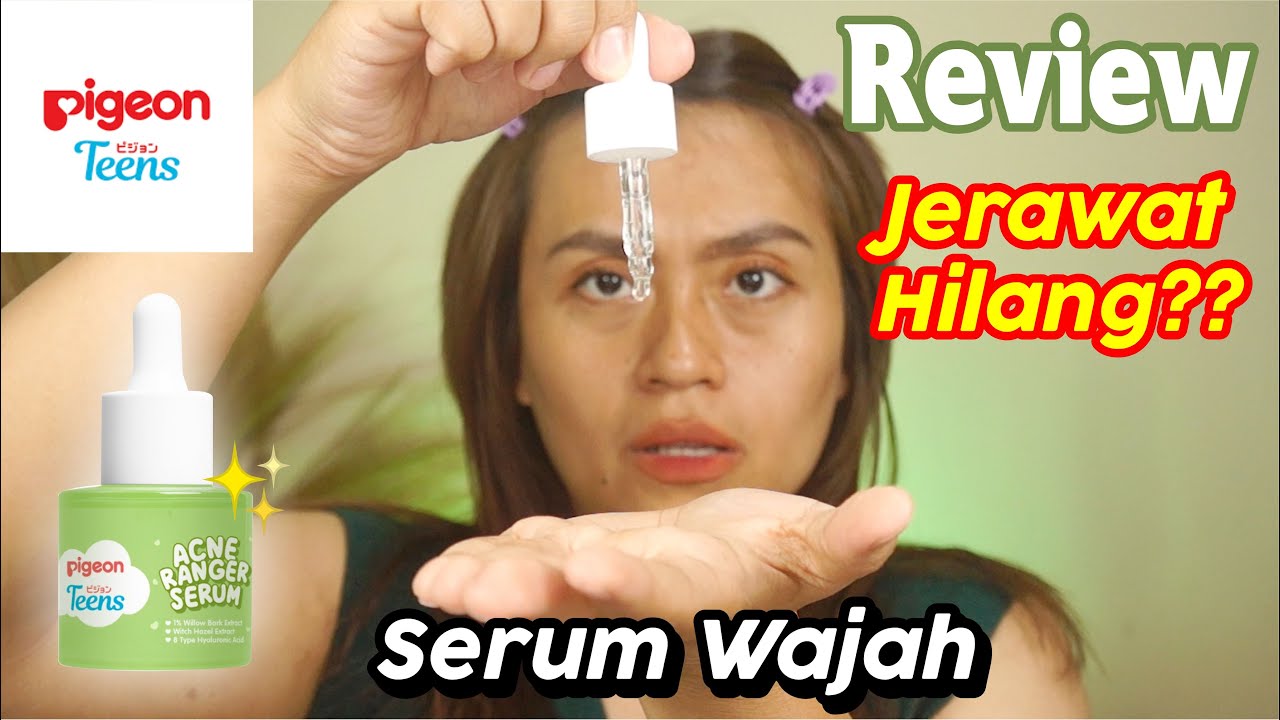 Review PIGEON TEENS Acne Ranger Serum | Risa Florendo