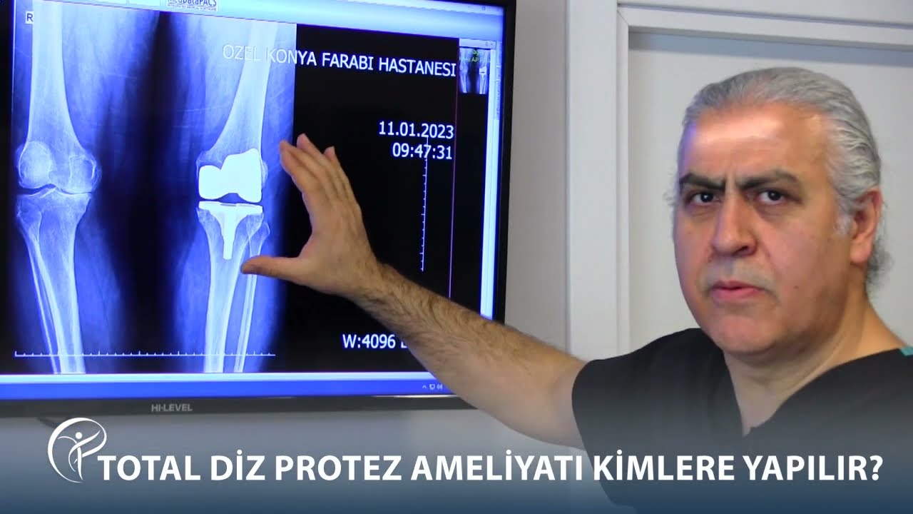 TOTAL DİZ PROTEZ AMELİYATI KİMLERE YAPILIR?